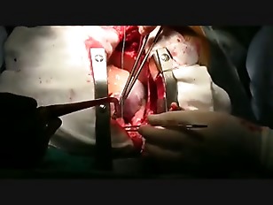 danny mccorkle add surgical porn photo