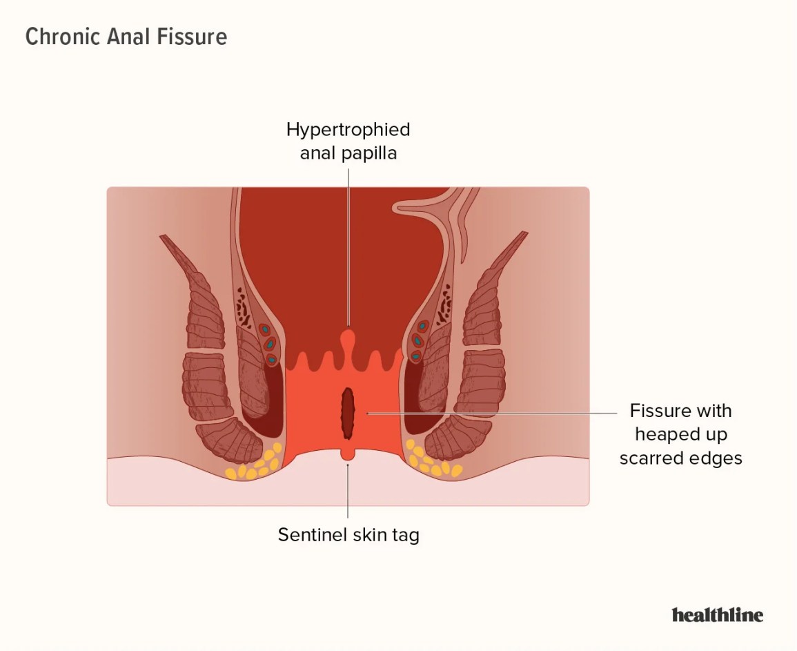 painful anal forced porn