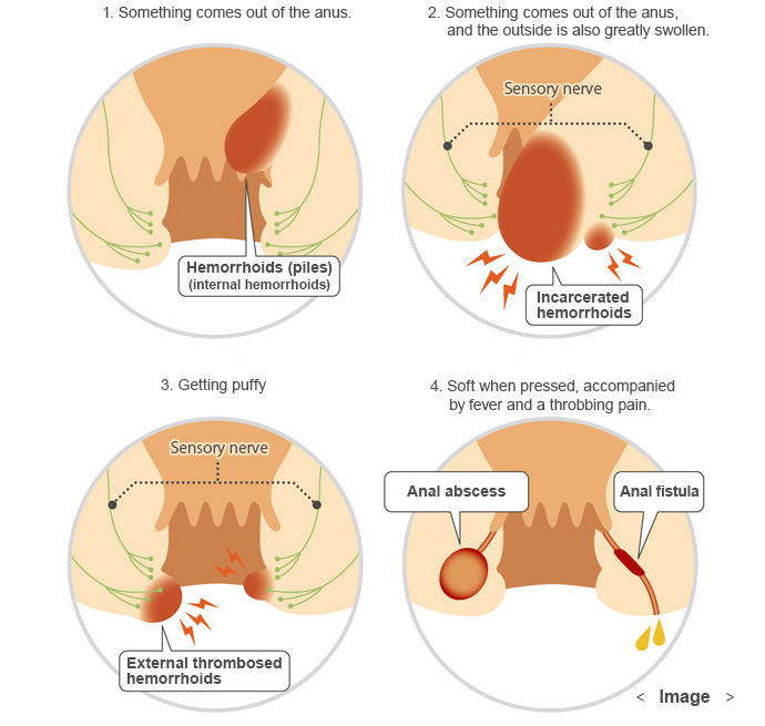 chidi mazi recommends anal category pic