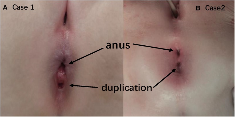 di silver recommends anal category pic