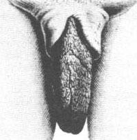 cherry maniez recommends big african clitoris pic