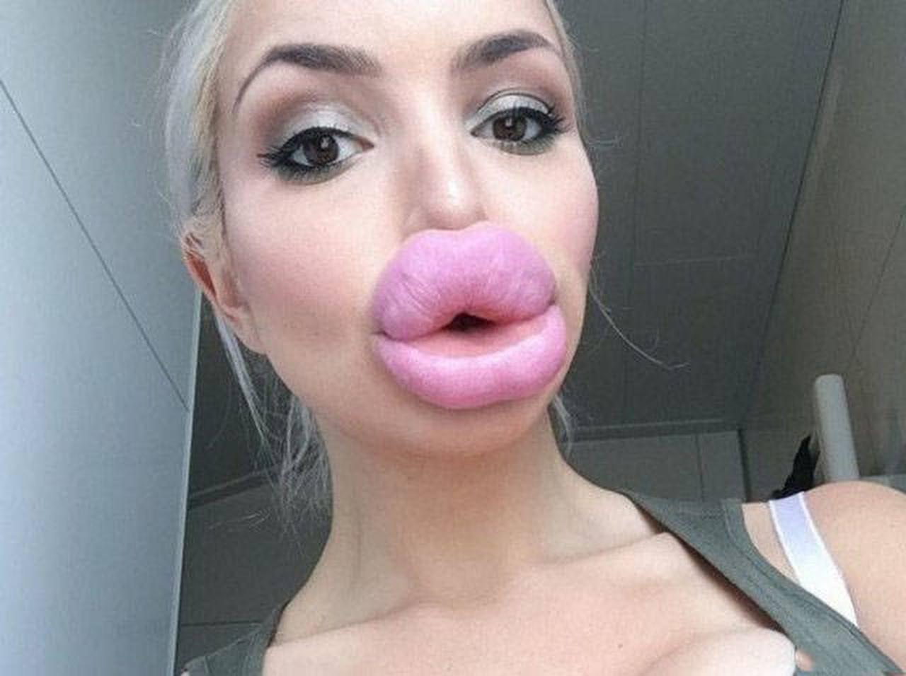 brodie mack recommends big lips porn pic