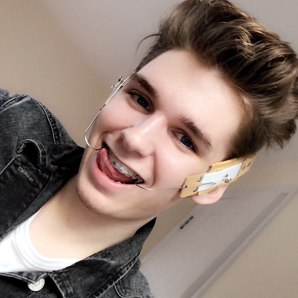 andri chan recommends twinks with braces pic