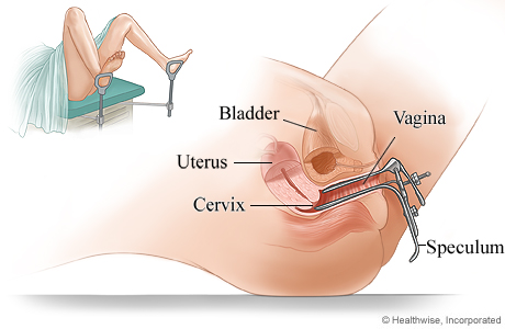 Gyno Exam Tube with cam