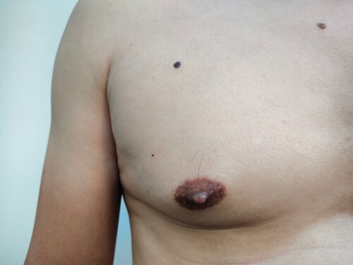 cindy bennetts recommends little puffy titties pic